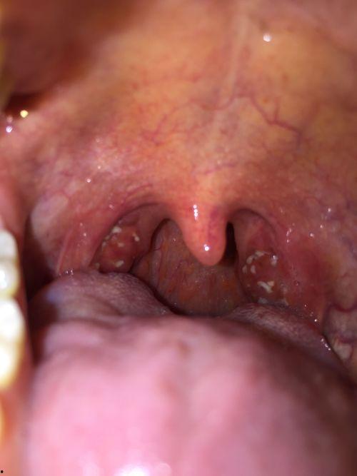 吃青皮瓜喉咙难受,揭秘食用禁忌与应对之道